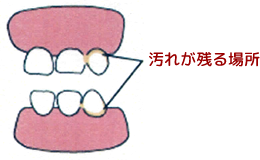 犬歯