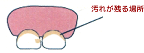 前歯
