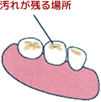 奥歯